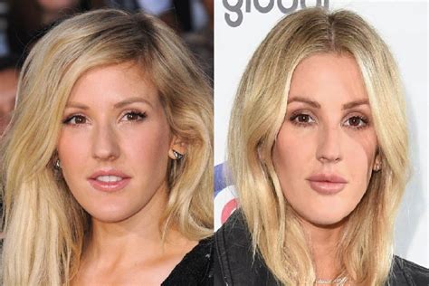 ellie goulding ellie goulding|ellie goulding before and after.